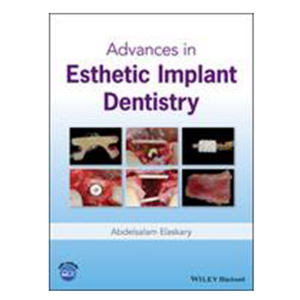 Advances in Esthetic Implant Dentistry